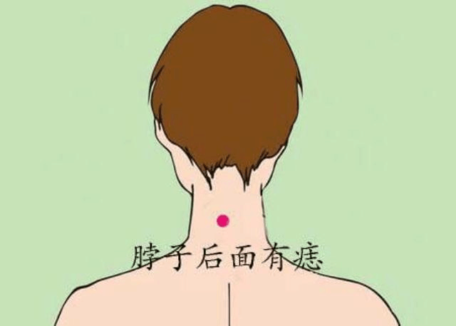 脖子后面 这颗痣体现了女性在婚姻生活中所遭遇的各种意外变故,不仅会