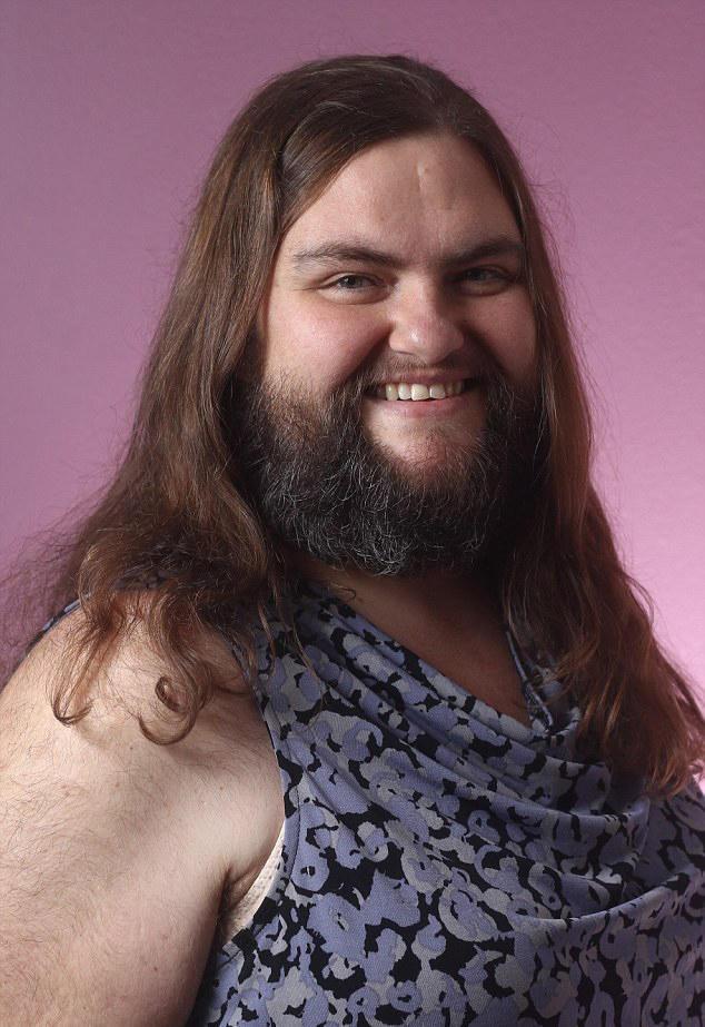 39岁女子,脸上长满络腮胡,还长有胸毛,还没男朋友!