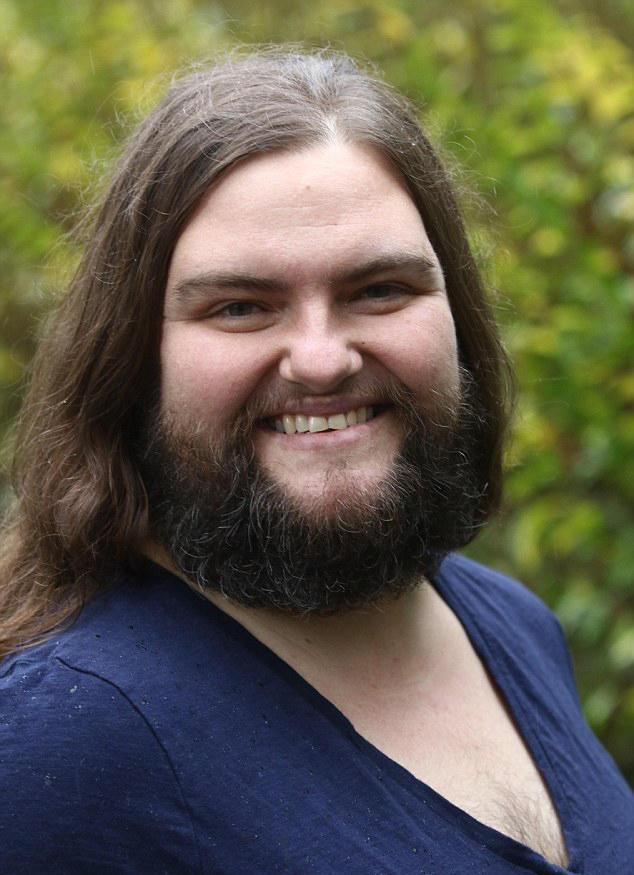 39岁女子,脸上长满络腮胡,还长有胸毛,还没男朋友!