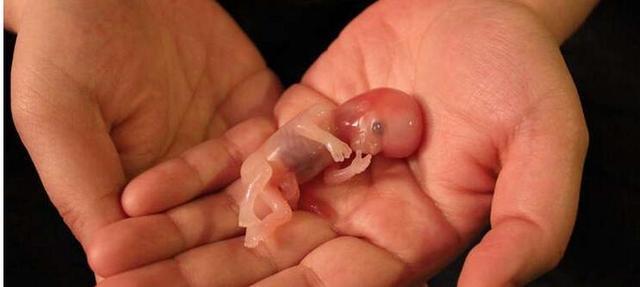 想知道怀男怀女,检查b超单上是否有这四个字,存在是男孩几率大