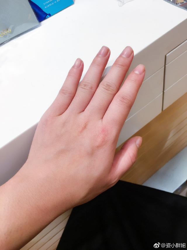 发微博说手越来越肿 网友:为母则刚