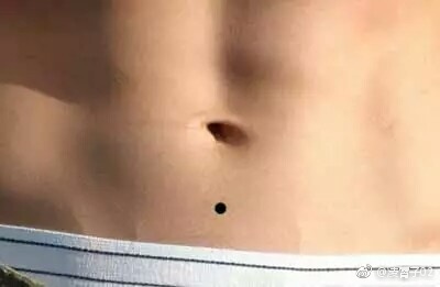 女人肚脐有痣意味着什么?