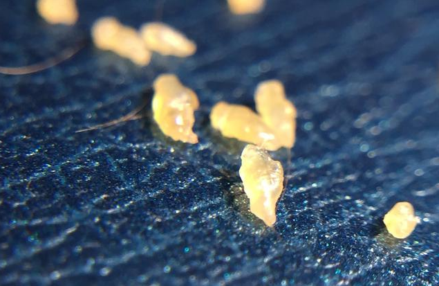 听听医生怎么说|耳垢|耳屎|外耳道_新浪新闻