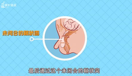 100个孩子中就有4个疝气宝宝快来检查一下你家孩子的腹股沟
