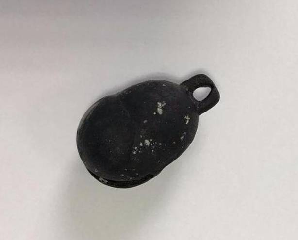 10岁女孩突然来例假,医生从盆腔取出的东西,气