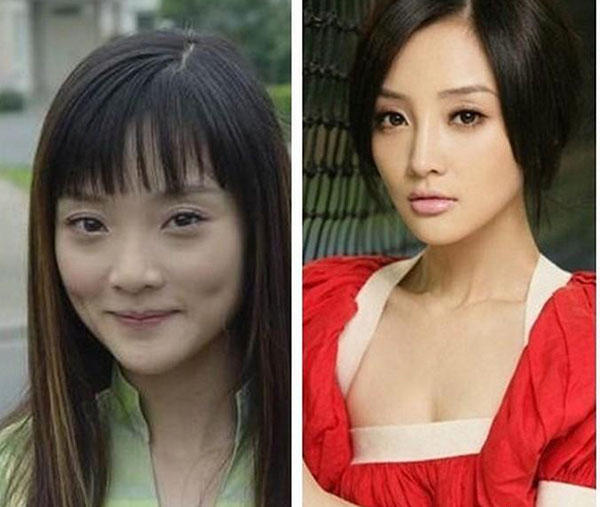 整容失败而惨遭毁容的10大女星,你还敢去整容吗?