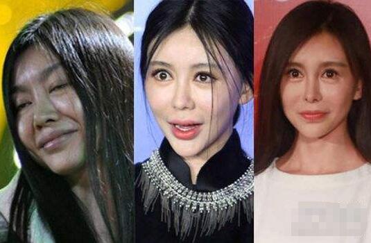细数因整容而变残的6位女星,都快认不出来了!