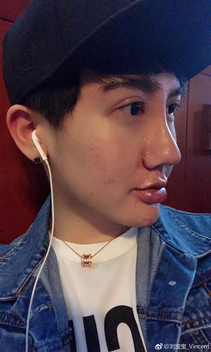 蛇精男刘梓辰再割双眼皮这次整成了泰国男星mike