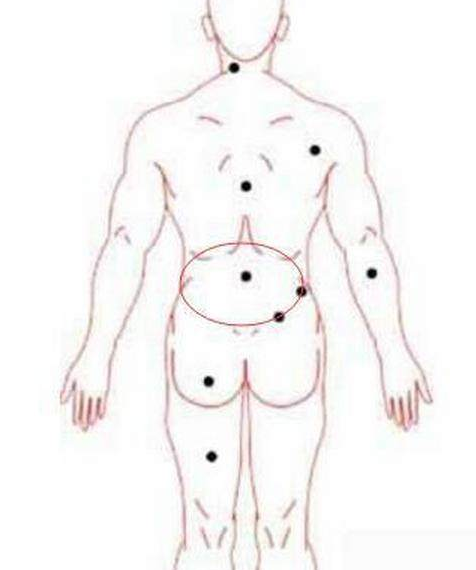你们知道身上长痣有什么寓意吗?有人会长寿,有人会发财