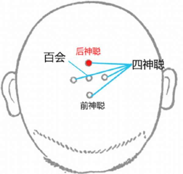 脑溢血属于意外伤害吗 脑溢血算不算意外保险