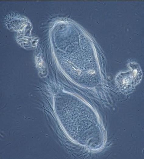 显微镜下的另类奇特世界犹如宇宙的外星生物