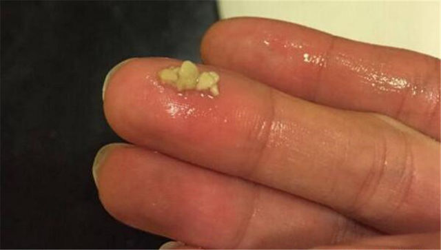 同学们都不愿意和这个男孩玩,得知原因后,妈妈急忙送医院去!