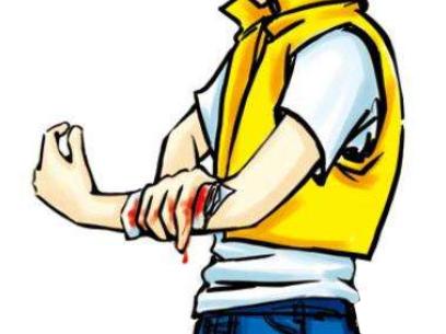 患者关注:外伤引起的白癜风怎么处理?