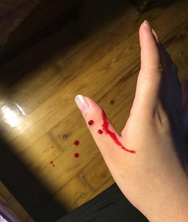 女主人带着猫咪做了绝育手术,没想到被猫咪报复,付出了血的代价