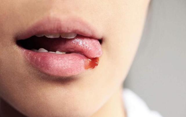 润唇膏|唇膏|嘴唇_新浪新闻