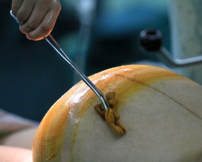 辛苦剖腹产迎来三胞胎,一看性别全家松口气