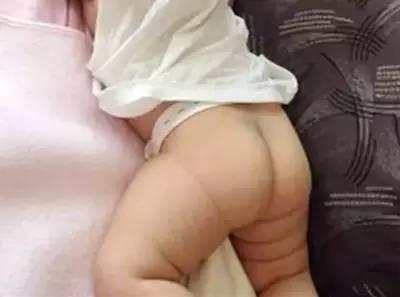 其实每个屁屁上有青痕的宝宝都是有故事