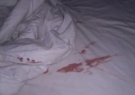 带血的床单落红图片