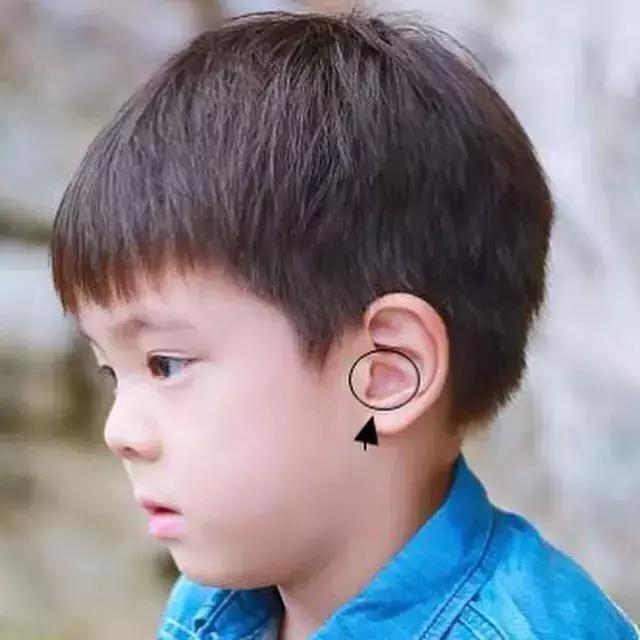 小时候的嗯哼还没有心形耳朵,而爸5其他萌娃婴儿时期你看过吗?