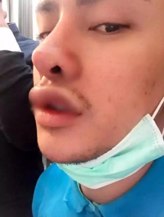 男子花30万整容30次,从丑男变成帅小伙,被无数美女倒追!