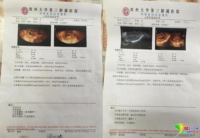 医院院护士把保胎药错发称孕妇禁用药孕妇隔天流产
