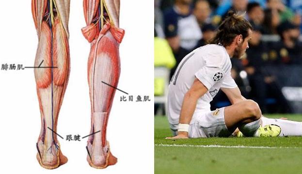 一旦背部出现问题,小腿肌肉就很容易撕裂或者拉伤