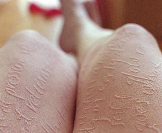 分辨艾滋病携带者 只需观察他的皮肤