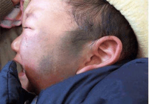 怀孕期间少做这3件事