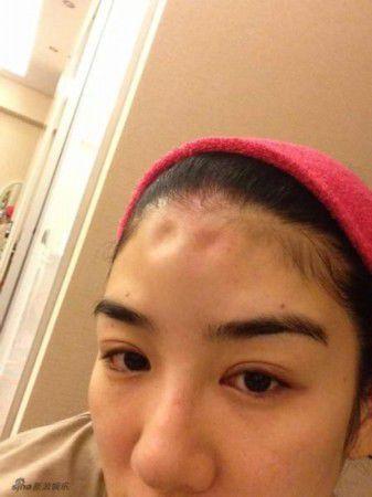 有网友爆料黄奕整容现场照片.