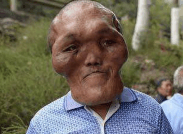 男子长相虽然丑陋, 但是却受到很多人追捧, 理由让人乐了|男子|长相|