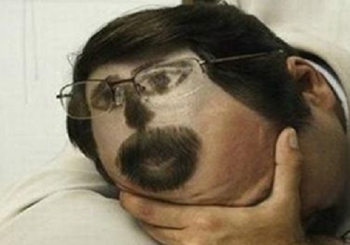 脱发去医院该挂哪个科?你肯定弄错了