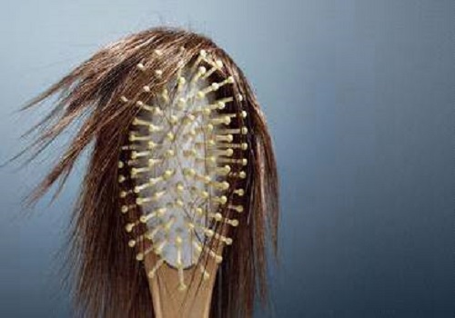 脱发去医院该挂哪个科?你肯定弄错了