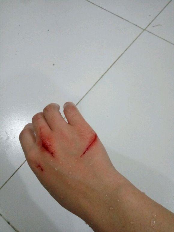 网友免费领养了一只白猫才没过几天手上伤痕累累