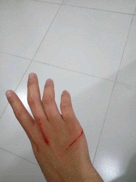 网友免费领养了一只白猫才没过几天手上伤痕累累