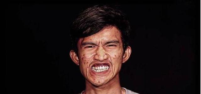 泰国丑陋小伙去韩国整容变大帅哥, 跟亲妈见面后被认为是陌生人!