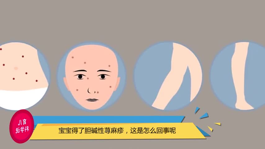 宝宝得了胆碱性荨麻疹,这是怎么回事呢