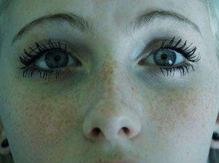 3个方法阻止黑色素沉着,让你脸上"斑点"早点下斑