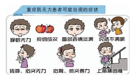 重症肌无力中医辨证分型__财经头条