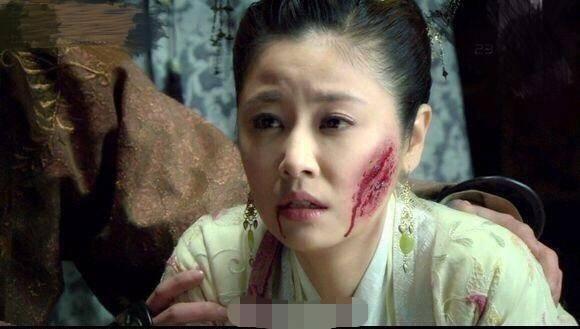 中国电视剧里的毁容vs泰国电视剧的毁容,原谅我笑出了声