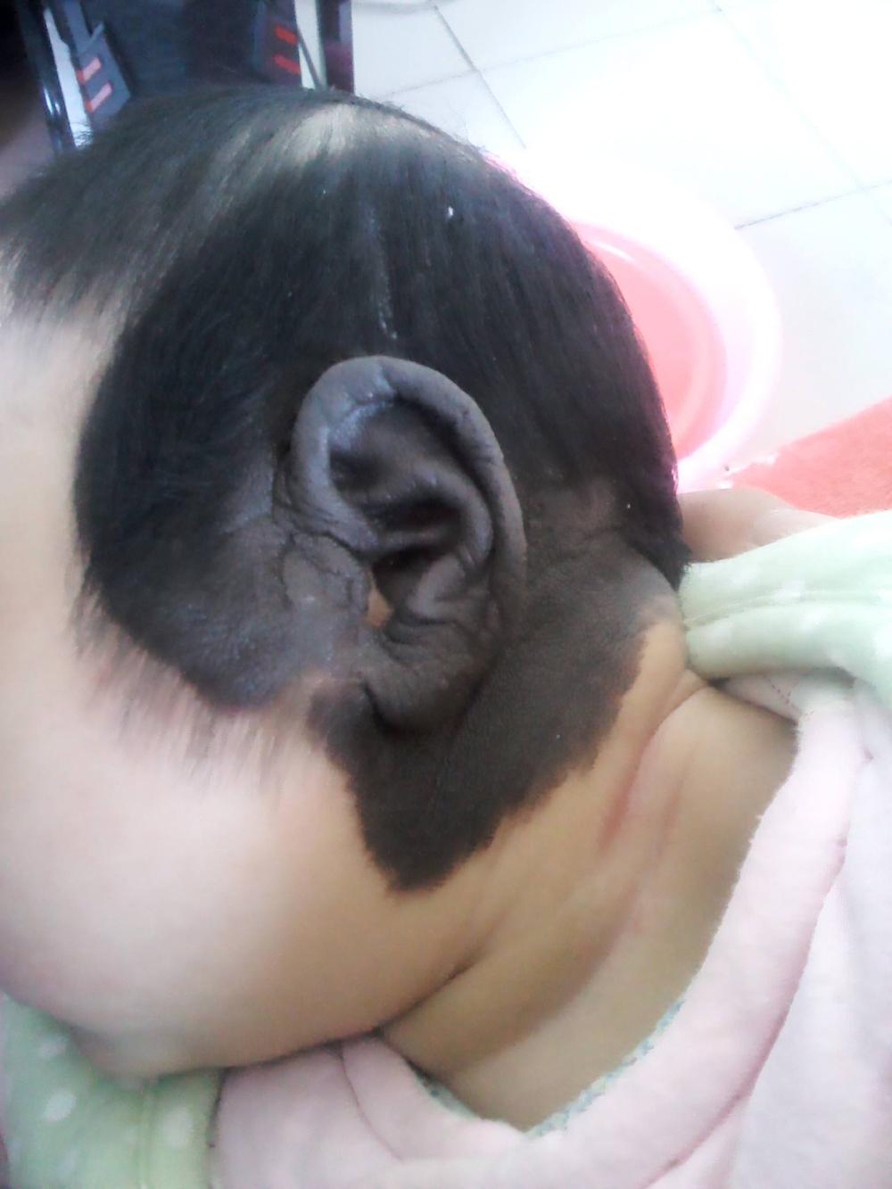 父母因孩子胎记而离婚准妈妈孕期多注意这几点宝宝健康无胎记