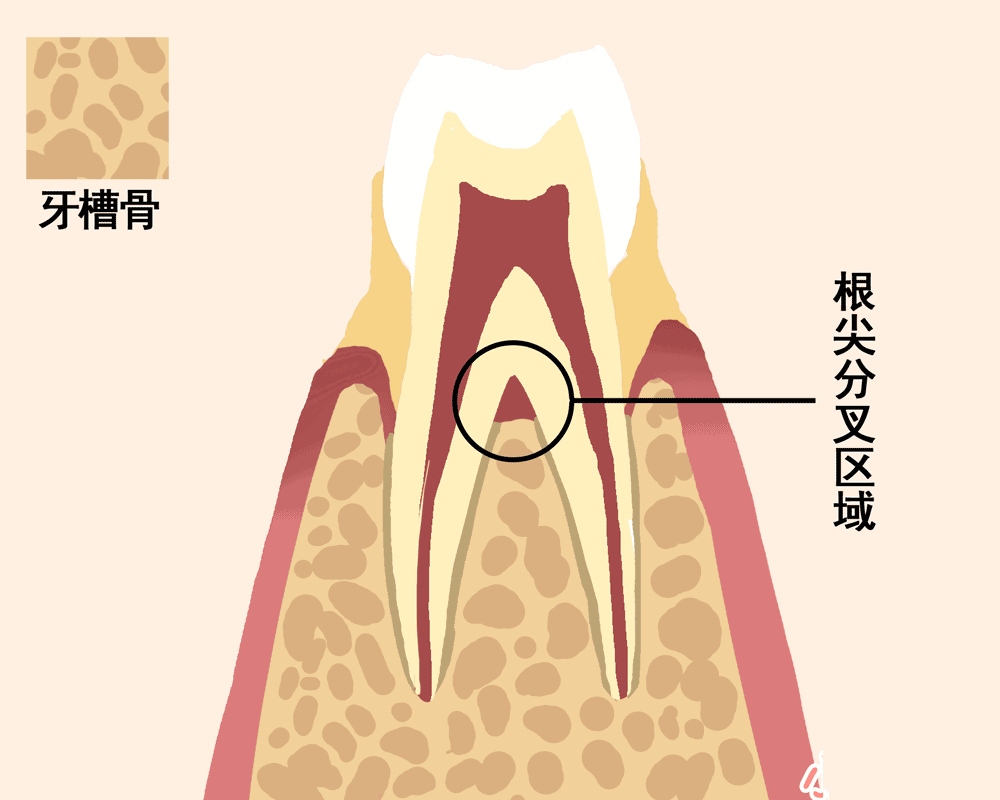 牙结石|牙周|牙龈_新浪新闻