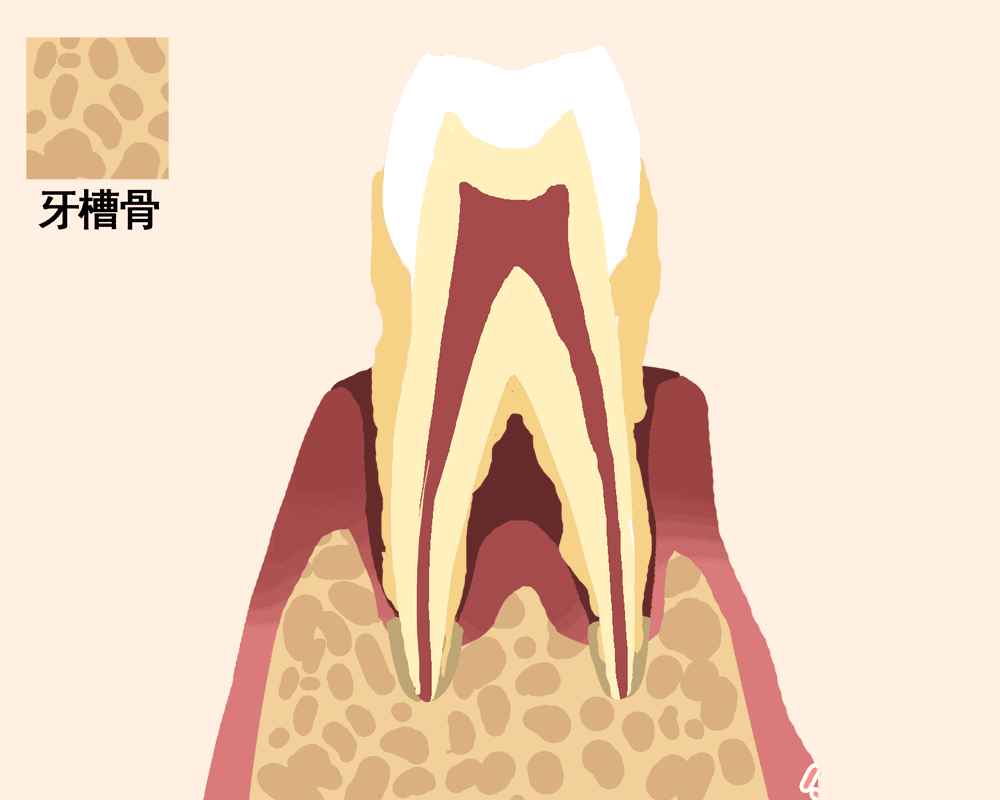 牙结石|牙周|牙龈_新浪新闻
