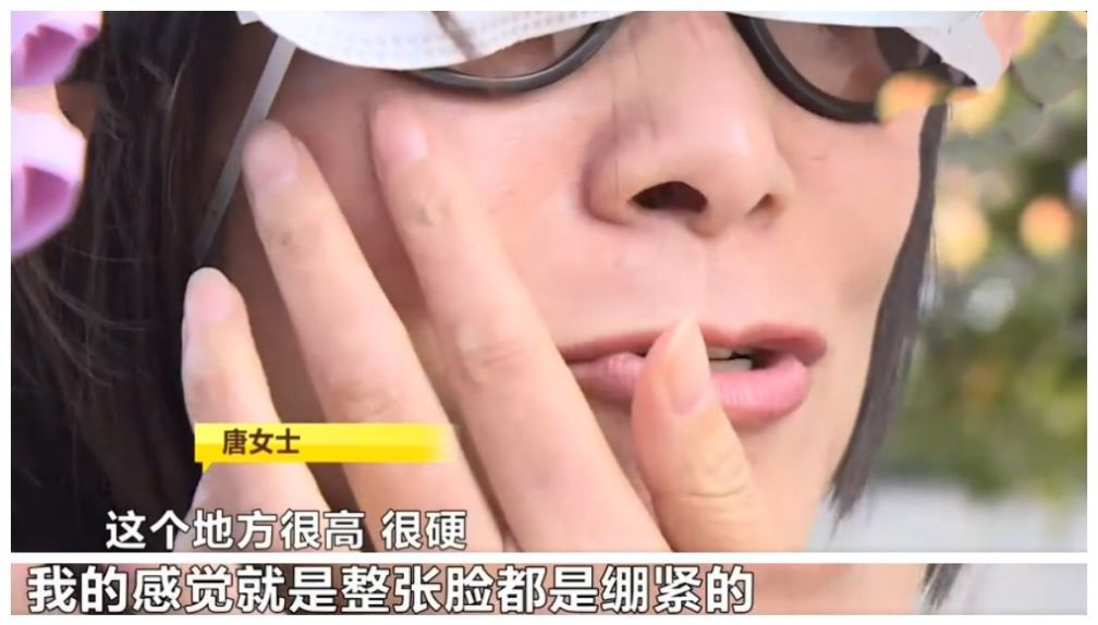长沙女子爱美注射除皱针,注射后面部僵硬都不能笑了!只能板着脸