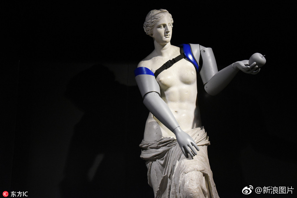 不再断臂 世界残疾人组织为维纳斯复制品装义肢