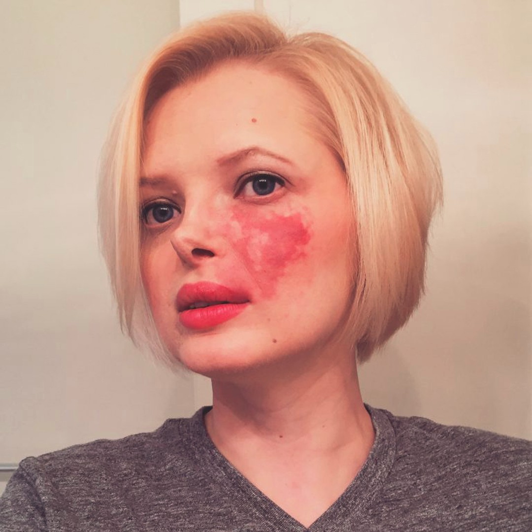 女子因脸上的胎记遭前夫抛弃,曾一度自卑如今勇敢面对获得真爱