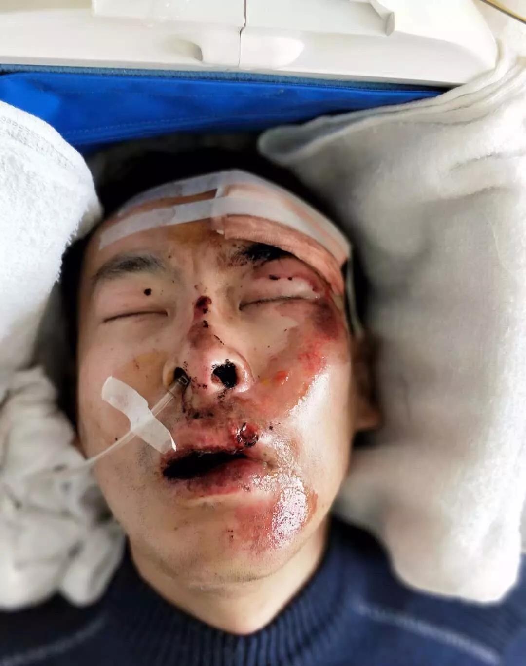 紧急接力!威海一男子被撞成重伤,伤者的家人你们在哪儿?