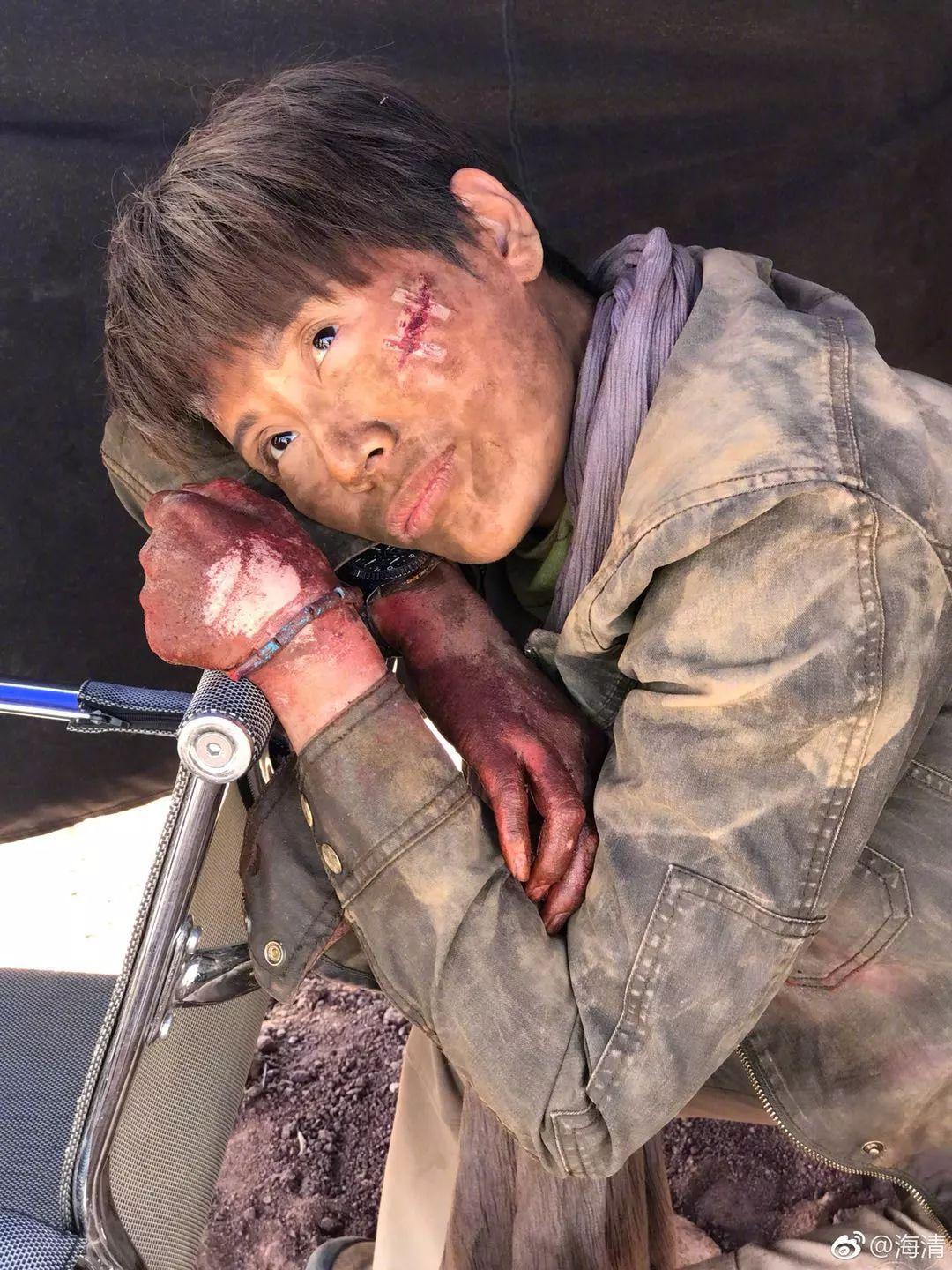 黄景瑜爆料海清拍戏太投入手腕骨裂