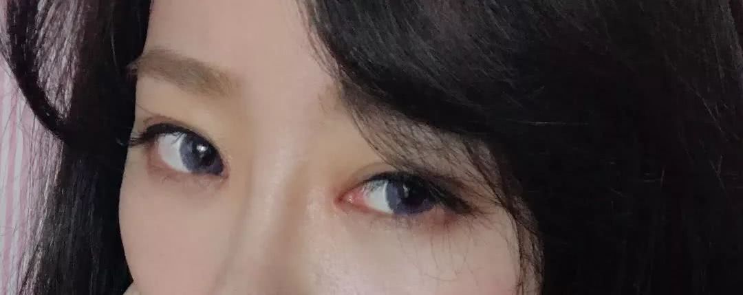 死鱼眼单身姑娘趁假期割了双眼皮,瞬间变电眼,好看死了!