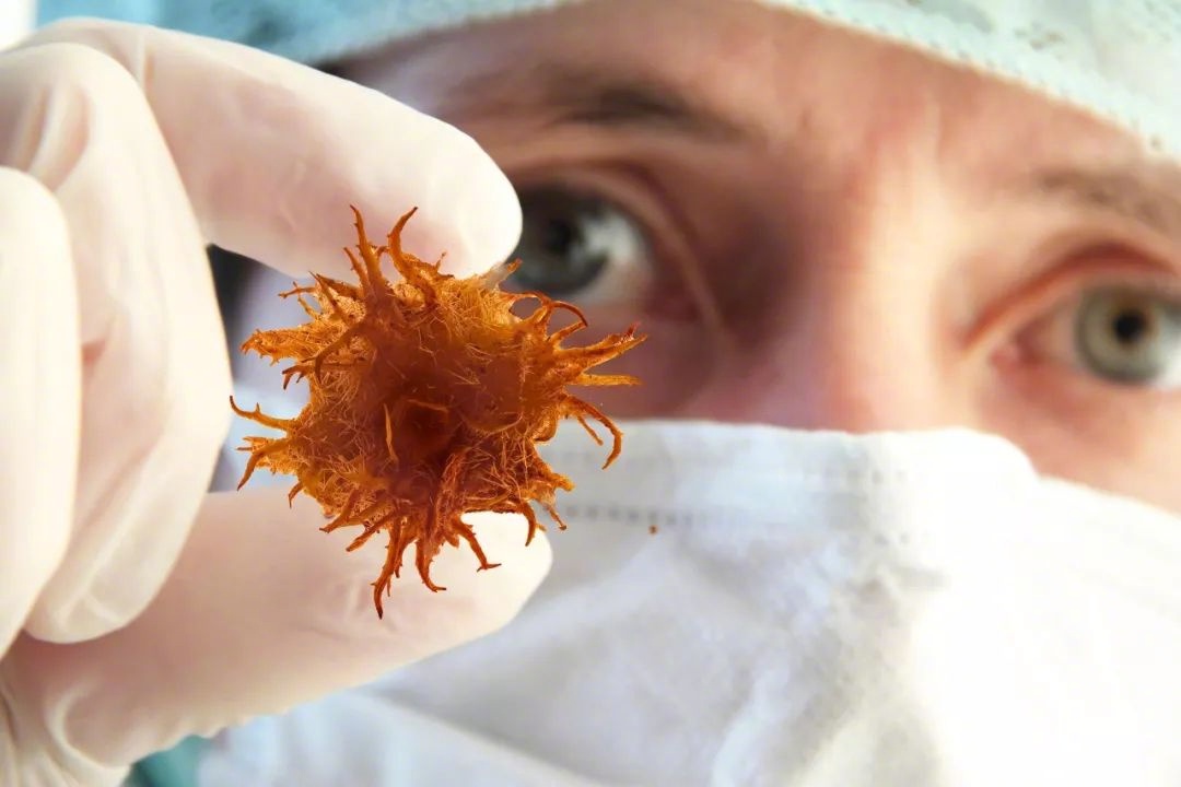 常见癌症的早期信号