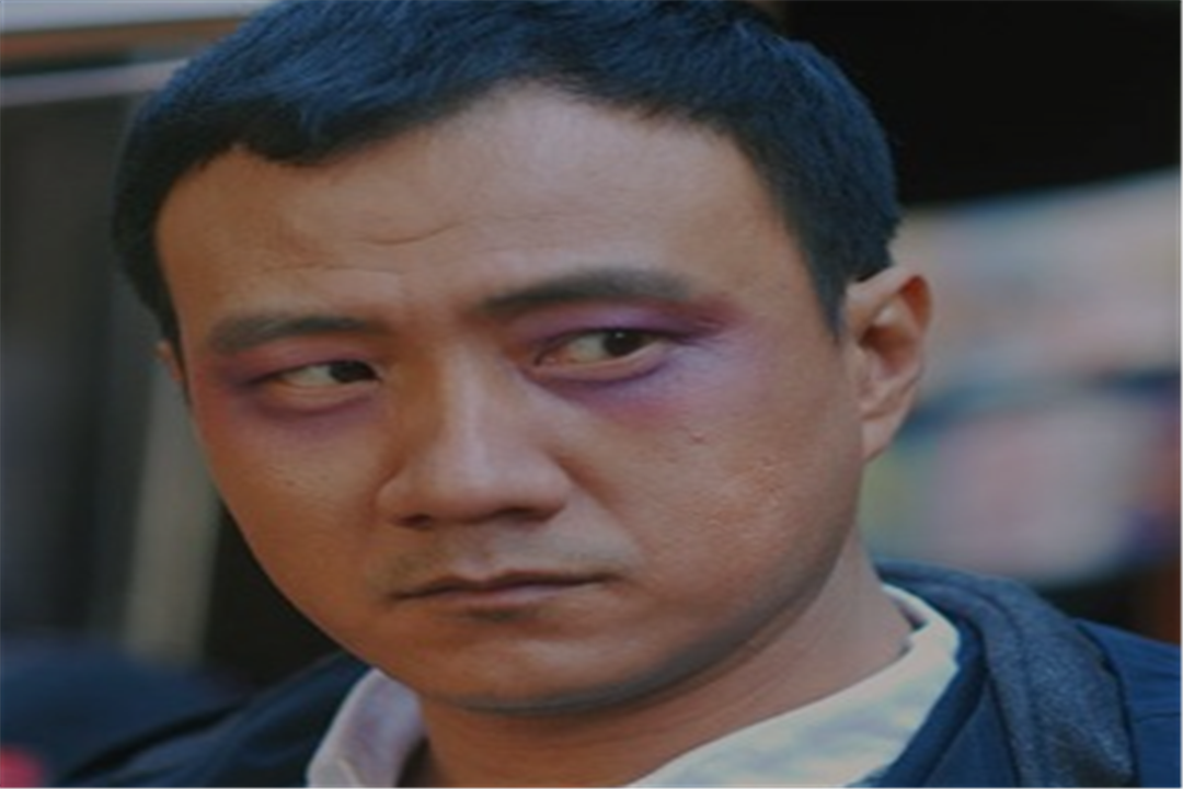 明目护眼有良方